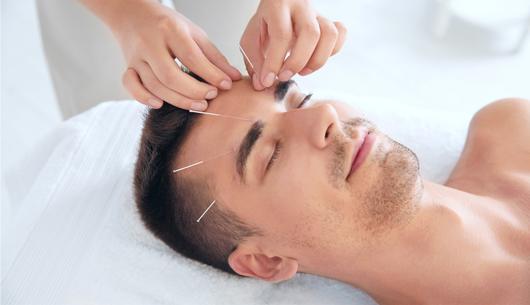 All About Acupuncture